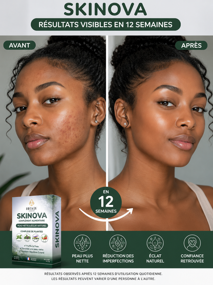 SKINOVA - Peau Nette et Éclat Naturel - Acné et Imperfections