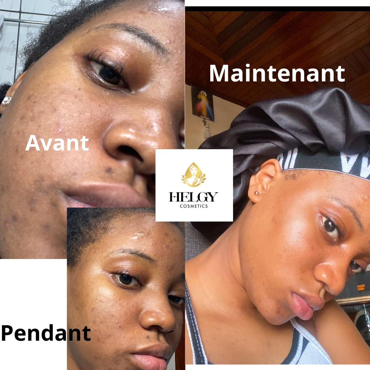 Gamme Visage Anti-Hyperpigmentation – Helgy COSMETICS - Helgy Cosmetics