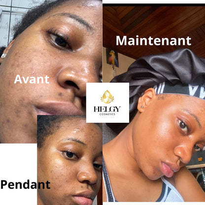 Gamme Visage Anti-Hyperpigmentation – Helgy COSMETICS - Helgy Cosmetics