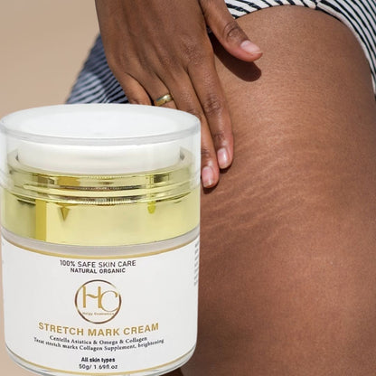 Crème Anti - Vergetures | STRETCH MARK CREAM - Helgy Cosmetics
