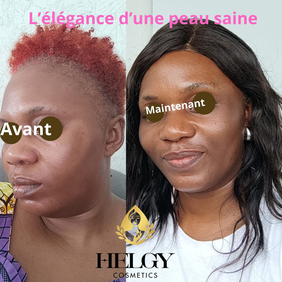 Gamme Visage Anti-Hyperpigmentation – Helgy COSMETICS - Helgy Cosmetics