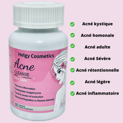 Acne Cleanse Capsules - Helgy Cosmetics